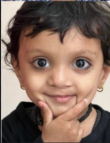 After Cleft Lip Repair